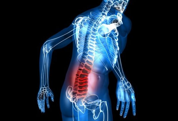 Symptoms of osteocondrosis