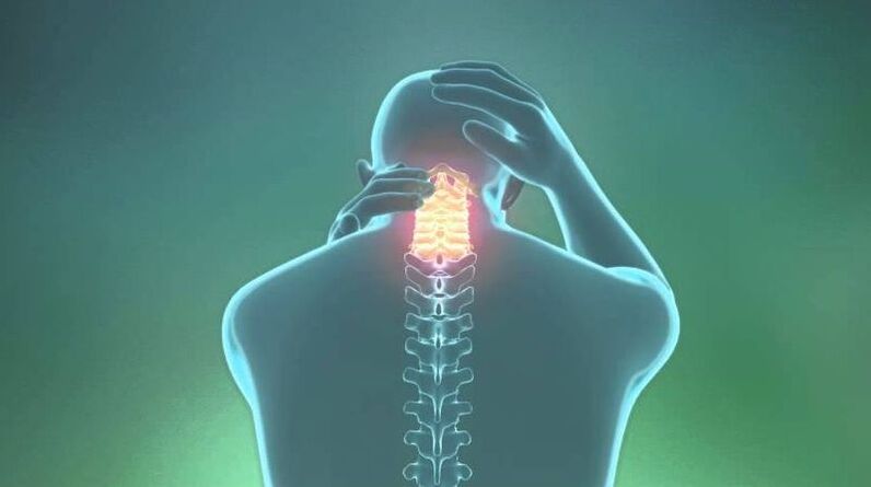 Osteocondrosis of cervical region