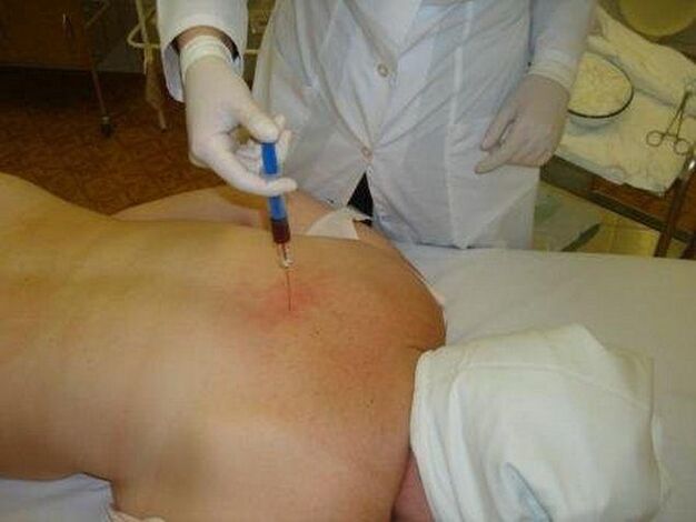 Preparations for osteocondrosis